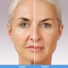 Comparatif avant/après